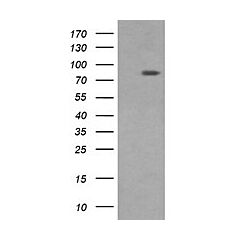 DNM1L (Myc-DDK-tagged)-Human Dynamin 1-like (DNM1L), transcript variant 1 