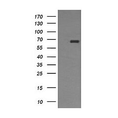 ENG (Myc-DDK-tagged)-Human Endoglin (ENG), transcript variant 2 
