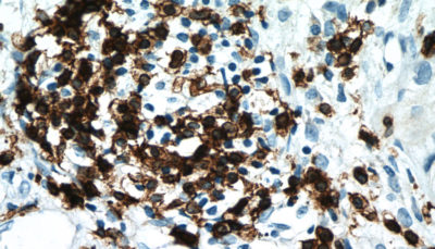 Antibodies in leukemia research and diagnosis