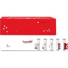 Influenza A H17N10 (A/little yellow-shouldered bat/Guatemala/164/2009) Hemagglutinin/ HA1 Protein (His)