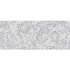 Estrogen Receptor Analyte ControlDR 