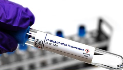 Liquid biopsy and cfDNA