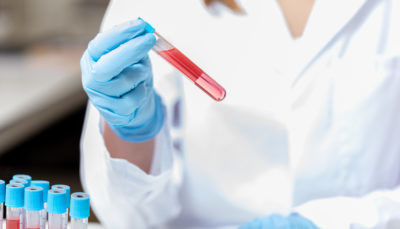 Recent Advances in the Preservation and Purification of Plasma cf-DNA and cf-RNA