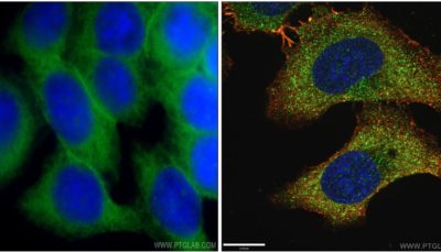 How to choose the right microscope setup for your experiment