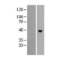 RHBDL1 (Myc-DDK-tagged)-Human Rhomboid, veinlet-like 1 (Drosophila) (RHBDL1) 