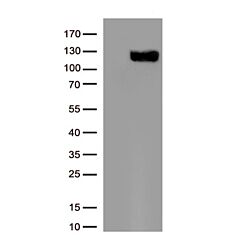 ACE2 Mouse Monoclonal Antibody [Clone ID: OTI3C2] (Angiotensin Converting Enzyme 2) 