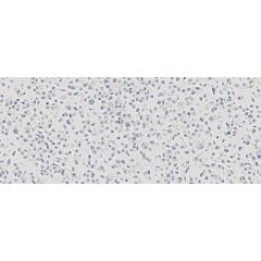 Estrogen Receptor Analyte ControlDR 