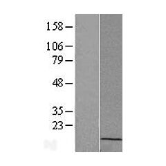MGC70863 (Myc-DDK-tagged)-Human similar to RPL23AP7 Protein (MGC70863), transcript variant 2 
