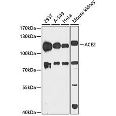 ACE2 Rabbit Polyclonal Antibody 