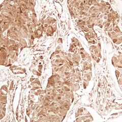 4E-BP1, EP352, rabbit, concentrate 