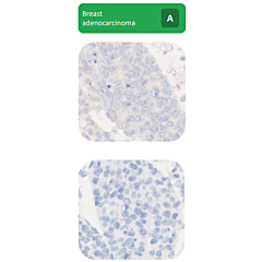 ALK Analyte ControlDR 