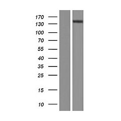 ATP2B2 (Myc-DDK-tagged)-Human ATPase, Ca++ transporting, plasma membrane 2 (ATP2B2), transcript vari ant 1