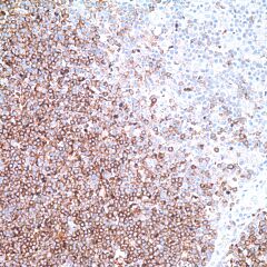 Rabbit anti-Human CD1a, clone EP3622 (Monoclonal) 