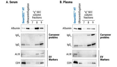 Finally, an EV isolation system in a 96-well format!