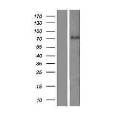 ABLIM3 (Myc-DDK-tagged)-Human actin binding LIM Protein family, member 3 (ABLIM3) 