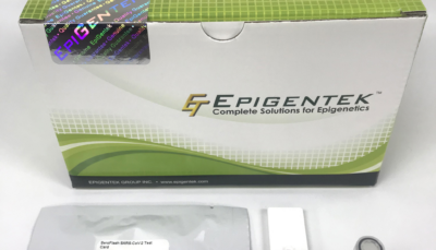 SeroFlash SARS-CoV-2 IgM/IgG Antibody Detection Kit