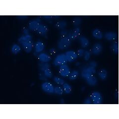 ROS1 Analyte Control 