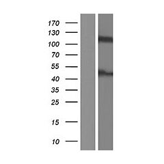 ASAP2 (Myc-DDK-tagged)-Human ArfGAP with SH3 domain, Ankyrin repeat and PH domain 2 (ASAP2), transcr ipt variant 1