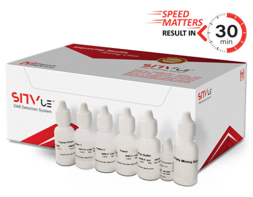 DBS SITvue/DAB Detection System