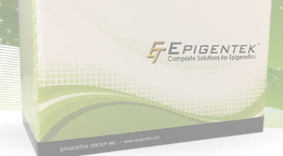 Complete Solutions for Epigenetics