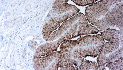 New Antibodies Released from DBS