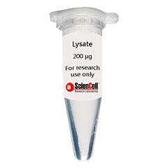Human Coronary Artery Endothelial Cell Lysate 