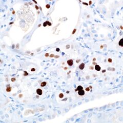 Mouse anti-Human SV-40, clone MRQ-4 (Monoclonal) 