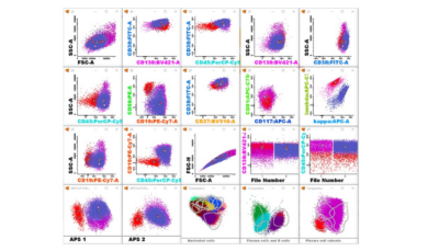 Experience with MM MRD in our clinical laboratory: theory and practice