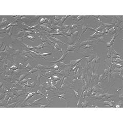 Human Leptomeningeal Pericytes 