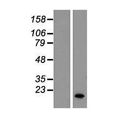 SERF1B (Myc-DDK-tagged)-Human small EDRK-rich factor 1B (Centromeric) (SERF1B), transcript variant 2 