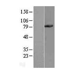 PCSK1 (Myc-DDK-tagged)-Human Proprotein convertase subtilisin/kexin type 1 (PCSK1),  transcript variant 1