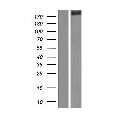 FLNA (Myc-DDK-tagged)-Human Filamin A, alpha (FLNA), transcript variant 1 