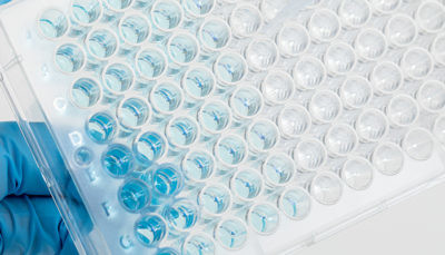 What are antibodies?