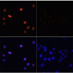 Acetyl Histone H3K14 Polyclonal Antibody 