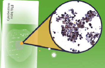 Control tissue with CytoSections