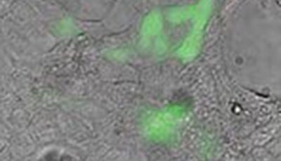 pPACK-SPIKE™ N501Y, SARS-CoV-2 “S” Pseudotype – N501Y Mutant – Lentivector Packaging Mix