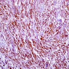 CITED1, 5H6, mouse, predilute 