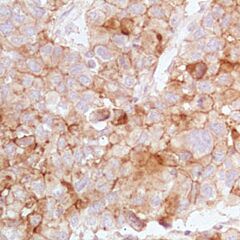 5T4, EP347, rabbit, concentrate 