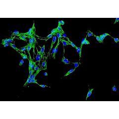 Human Adrenal Fibroblasts 