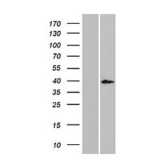 DCDC1 (Myc-DDK-tagged)-Human Doublecortin domain containing 1 (DCDC1) 