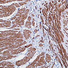 Actin, Smooth Muscle, 1A4, mouse, predilute 