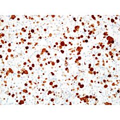 HPV/p16 Analyte ControlDR 