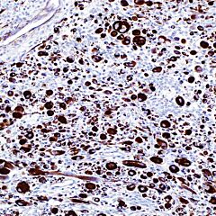 Actin, Muscle Specific, HHF35, mouse, predilute 