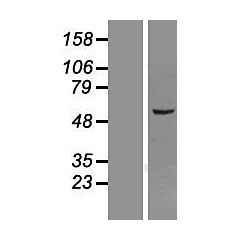 TROVE2 (Myc-DDK-tagged)-Human TROVE domain family, member 2 (TROVE2), transcript variant 2 