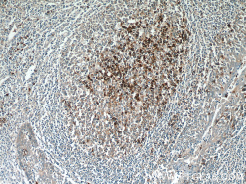 Leukemia CD38 Antibody