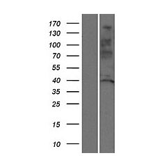 SSUH2 (Myc-DDK-tagged)-Human Chromosome 3 open reading frame 32 (C3orf32) 