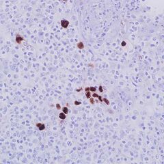 Adenovirus, 20/11 & 2/6, mouse, concentrate 