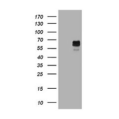 TYR (Myc-DDK-tagged)-Human tyrosinase (Oculocutaneous albinism IA) (TYR) 