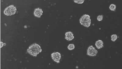 NEW: Ready-To-Use 3D Human Blood Brain Barrier Spheroid Kit with HBMEC