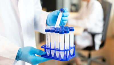 Zymo Quick-16S Plus NGS Library Prep Kit